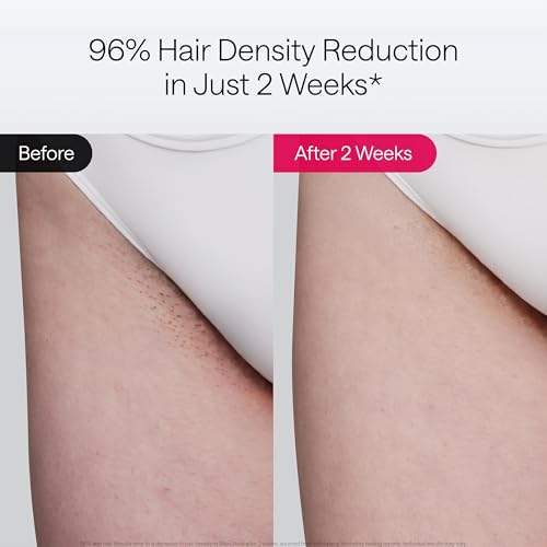 Ulike Air 10 IPL Laser Hair Removal Device for Women and Men M997341