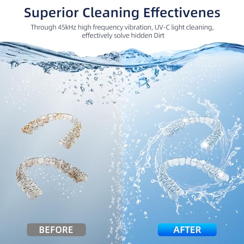Ultrasonic Retainer Cleaner for Dentures, Mouth Guards, Braces, Jewelry, 200ML, 45kHz X607