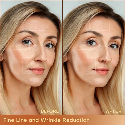MLAY Professional RF Beauty Machine with 2 Probes for Skin Tightening G829145
