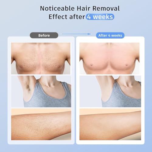 Ubroo IPL Laser Hair Removal Device with 5℃ Ice Cooling for Women Men C227628