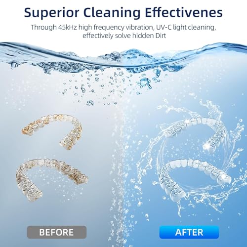 Ultrasonic Retainer Cleaner for Dentures, Mouth Guards, Braces, Jewelry, 200ML, 45kHz X607