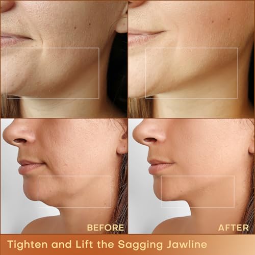 MLAY Professional RF Beauty Machine with 2 Probes for Skin Tightening G829145